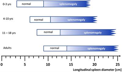 Splenomegaly in Children and Adolescents